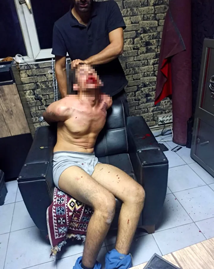 bocek yedirip dislerini kirdilar savci 20ser yil mahpus cezasi istedi 3 WMqNZdkO