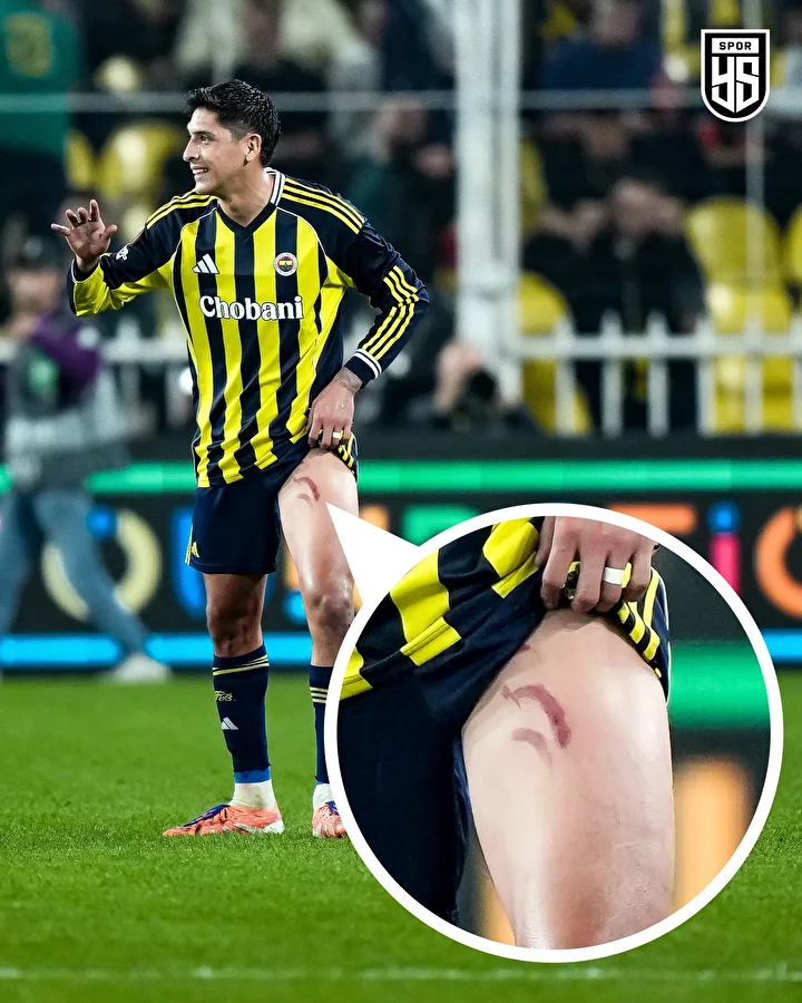 Fenerbahçeli yıldızın bacağının son hali şoke etti! Hakem sarı kartla geçiştirdi 3 fenerbahceli yildizin bacaginin son hali soke etti hakem sari kartla gecistirdi 2 AXdnBZqe