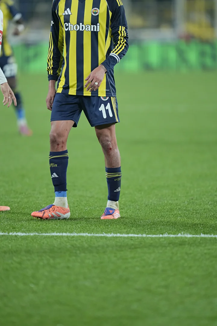 Fenerbahçeli yıldızın bacağının son hali şoke etti! Hakem sarı kartla geçiştirdi 5 fenerbahceli yildizin bacaginin son hali soke etti hakem sari kartla gecistirdi 4 R4ZXrhga