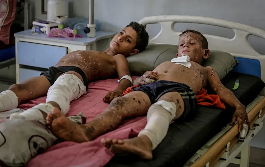 gazzede patlamamis muhimmat infilak etmesi iki cocugu agir yaraladi 0