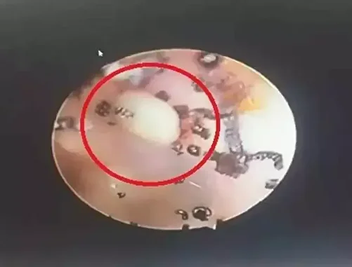 kucuk kizin kulak agrisinin altindan cikan gercek tuyler urpertti 1 FfRn8gnl