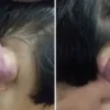 kucuk kizin kulak agrisinin altindan cikan gercek tuyler urpertti 55NjdMS9.webp
