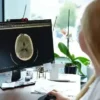 kume bas agrisi nedir belirtileri nelerdir uzmanindan degerli ikazlar X61SFGsk.webp