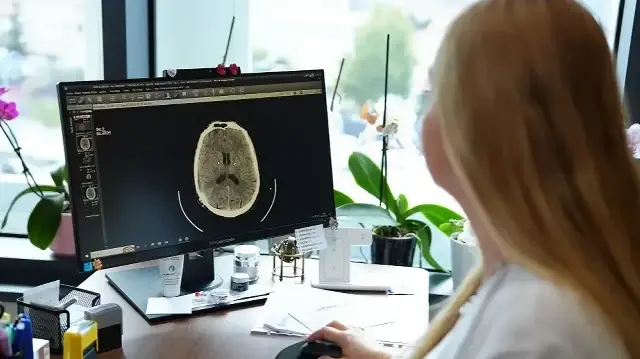 kume bas agrisi nedir belirtileri nelerdir uzmanindan degerli ikazlar X61SFGsk.webp