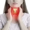lenfomada erken teshis fark yaratiyor yeni tedaviler umut veriyor iBh6am7T.webp