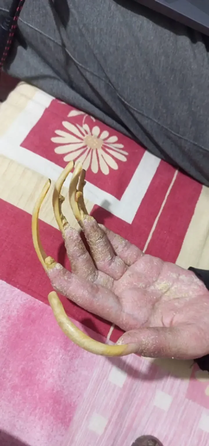 telefon bagimlisi genc 3 yildir meskenden disari ne tek bir adim atti ne de TnHFwh1t