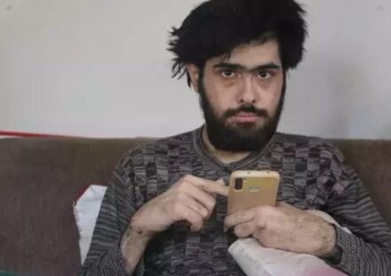 Türkiye’nin konuştuğu ve 3 yıldır tırnaklarını kesmeyen gencin eski hali ortaya çıktı turkiyenin konustugu ve 3 yildir tirnaklarini kesmeyen gencin eski hali ortaya cikti RevMSxWb.jpg