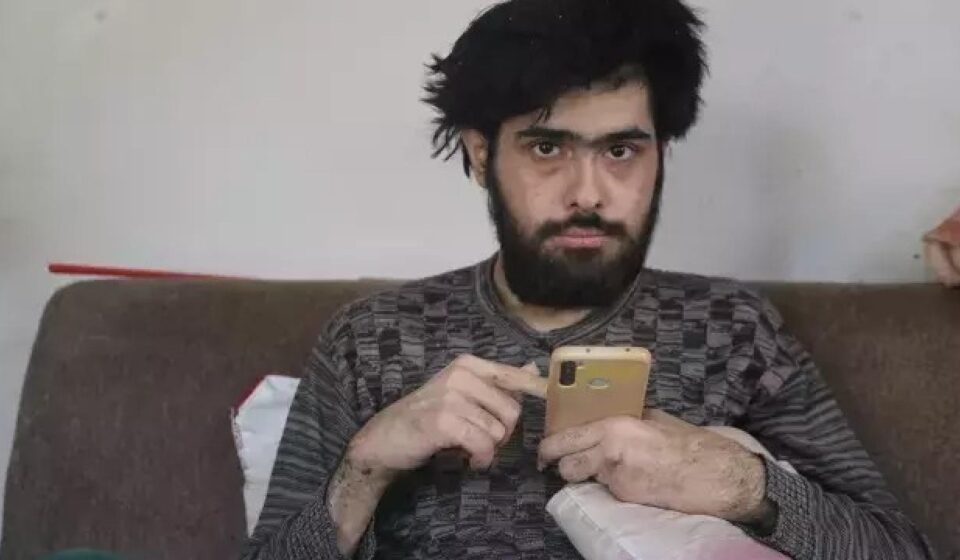 Türkiye’nin konuştuğu ve 3 yıldır tırnaklarını kesmeyen gencin eski hali ortaya çıktı turkiyenin konustugu ve 3 yildir tirnaklarini kesmeyen gencin eski hali ortaya cikti RevMSxWb.jpg
